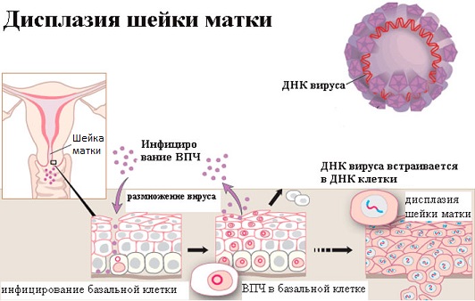 Как лечить непроходимость кишечника у собак Как лечить непроходимость кишечника у собак