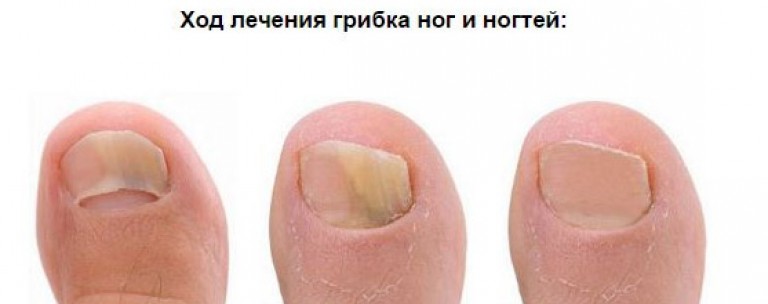 Врач при заболеваниях ногтей Врач при заболеваниях ногтей
