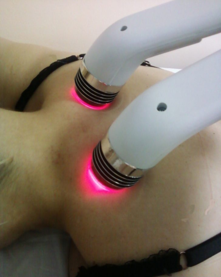Что такое фотодинамическая терапия в гинекологии