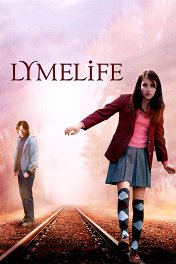 Роскошная жизнь / Lymelife