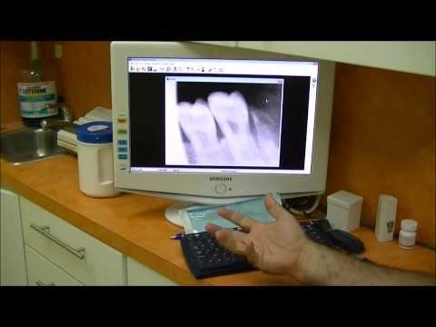 Digital radiography - Wikipedia